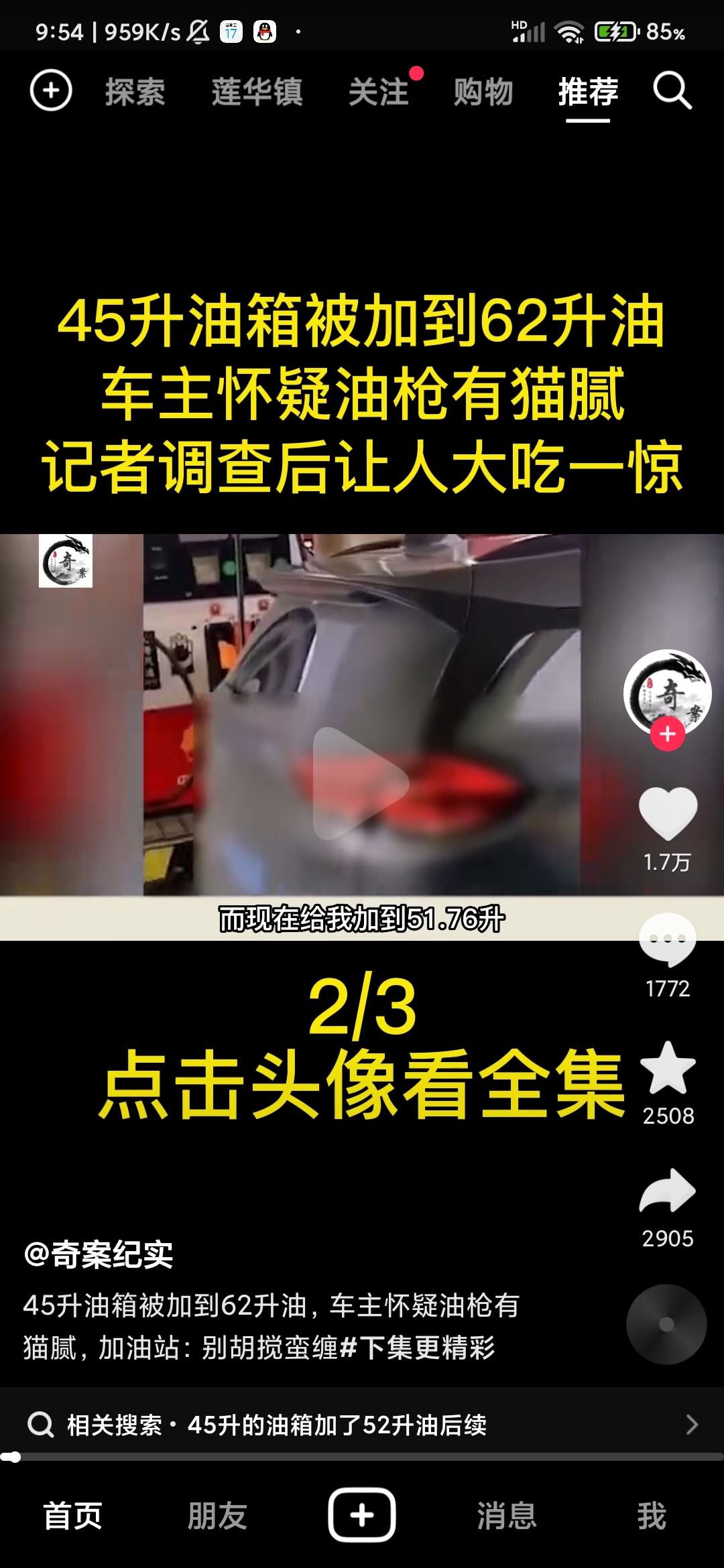 抖音頭像上快進(jìn)按鈕怎么設(shè)置？