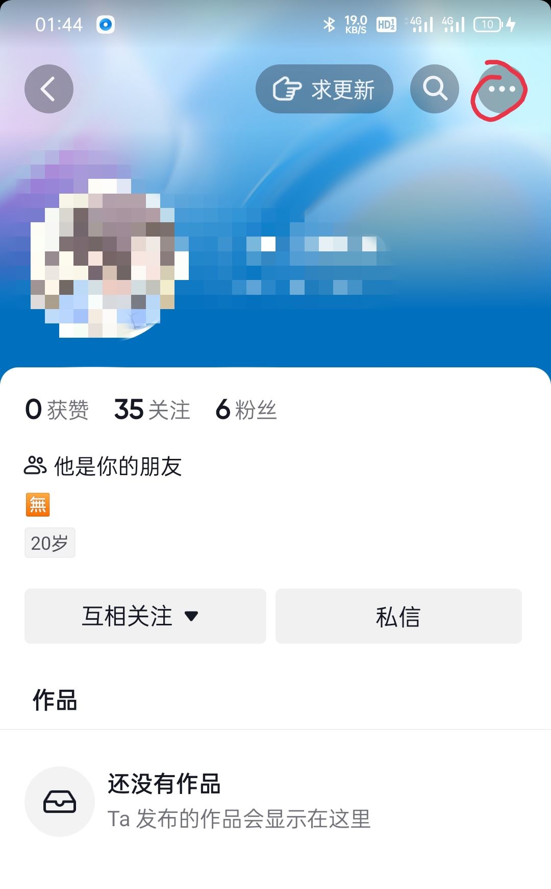 怎么移除抖音上面的朋友，對(duì)方會(huì)知道嗎？